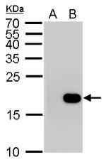 Phospho-Histone H3 (Ser10) Antibody in Western Blot (WB)