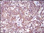 MRP4 Antibody in Immunohistochemistry (Paraffin) (IHC (P))