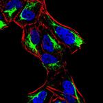 ATF3 Antibody in Immunocytochemistry (ICC/IF)