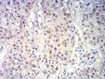 BCL11B Antibody in Immunohistochemistry (Paraffin) (IHC (P))