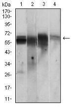 CaMKII gamma Antibody in Western Blot (WB)