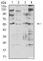 CHRNA2 Antibody in Western Blot (WB)