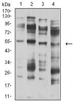 CHRNA5 Antibody in Western Blot (WB)