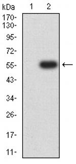 CHRNA5 Antibody in Western Blot (WB)