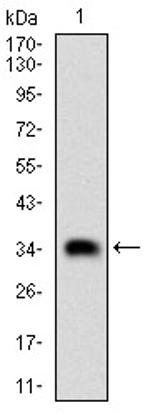 CK2 beta Antibody in Western Blot (WB)
