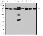 DDX1 Antibody in Western Blot (WB)