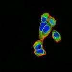 Emerin Antibody in Immunocytochemistry (ICC/IF)