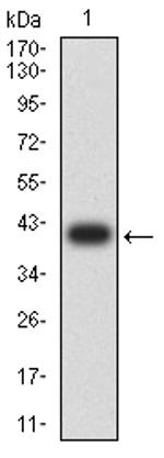 NMDAR3B Antibody in Western Blot (WB)