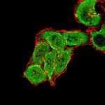 mGluR7 Antibody in Immunocytochemistry (ICC/IF)