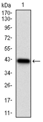 NPC1 Antibody in Western Blot (WB)