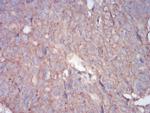 RALA Antibody in Immunohistochemistry (Paraffin) (IHC (P))