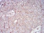 RALA Antibody in Immunohistochemistry (Paraffin) (IHC (P))