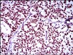 RING1 Antibody in Immunohistochemistry (Paraffin) (IHC (P))