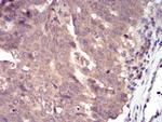 SSH1 Antibody in Immunohistochemistry (Paraffin) (IHC (P))