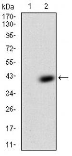 TFF2 Antibody in Western Blot (WB)