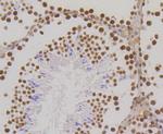 H3K18me1 Antibody in Immunohistochemistry (Paraffin) (IHC (P))