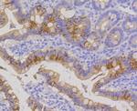 Cytokeratin 20 Antibody in Immunohistochemistry (Paraffin) (IHC (P))