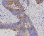 Cytokeratin 20 Antibody in Immunohistochemistry (Paraffin) (IHC (P))