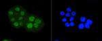 Phospho-Rb (Ser807) Antibody in Immunocytochemistry (ICC/IF)