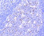 Phospho-Rb (Ser807) Antibody in Immunohistochemistry (Paraffin) (IHC (P))