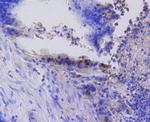 Phospho-Rb (Ser807) Antibody in Immunohistochemistry (Paraffin) (IHC (P))