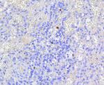 Phospho-Rb (Ser807) Antibody in Immunohistochemistry (Paraffin) (IHC (P))