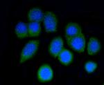 ARPC5 Antibody in Immunocytochemistry (ICC/IF)