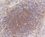 ARPC5 Antibody in Immunohistochemistry (Paraffin) (IHC (P))