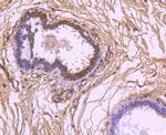 VEGF Antibody in Immunohistochemistry (Paraffin) (IHC (P))