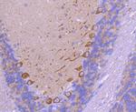 VEGF Antibody in Immunohistochemistry (Paraffin) (IHC (P))