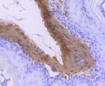 Calponin 1 Antibody in Immunohistochemistry (Paraffin) (IHC (P))