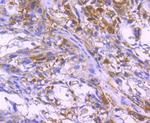 Paxillin Antibody in Immunohistochemistry (Paraffin) (IHC (P))