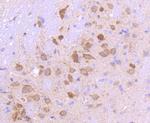SMAD3 Antibody in Immunohistochemistry (Paraffin) (IHC (P))