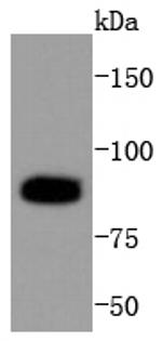 PARP1 (cleaved Asp214) Antibody in Western Blot (WB)