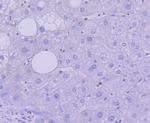 Active/Pro-Caspase 3 Antibody in Immunohistochemistry (Paraffin) (IHC (P))