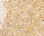 PIK3R2 Antibody in Immunohistochemistry (Paraffin) (IHC (P))