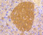 Phospho-PP2A alpha (Tyr307) Antibody in Immunohistochemistry (Paraffin) (IHC (P))