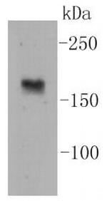 nNOS Antibody in Western Blot (WB)