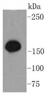 Phospho-SMC1 (Ser957) Antibody in Western Blot (WB)