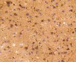 COX1 Antibody in Immunohistochemistry (Paraffin) (IHC (P))