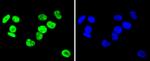 hnRNP C1/C2 Antibody in Immunocytochemistry (ICC/IF)