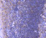 Bcl-10 Antibody in Immunohistochemistry (Paraffin) (IHC (P))