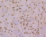 Cdc40 Antibody in Immunohistochemistry (Paraffin) (IHC (P))