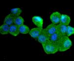 Cdc34 Antibody in Immunocytochemistry (ICC/IF)