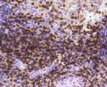 CD3d Antibody in Immunohistochemistry (Paraffin) (IHC (P))