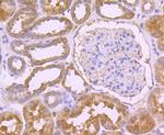 CD3d Antibody in Immunohistochemistry (Paraffin) (IHC (P))