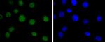 BMI-1 Antibody in Immunocytochemistry (ICC/IF)