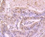 S100A6 Antibody in Immunohistochemistry (Paraffin) (IHC (P))