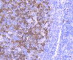 TK1 Antibody in Immunohistochemistry (Paraffin) (IHC (P))