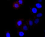 Cathepsin H/K/L/V Antibody in Immunocytochemistry (ICC/IF)